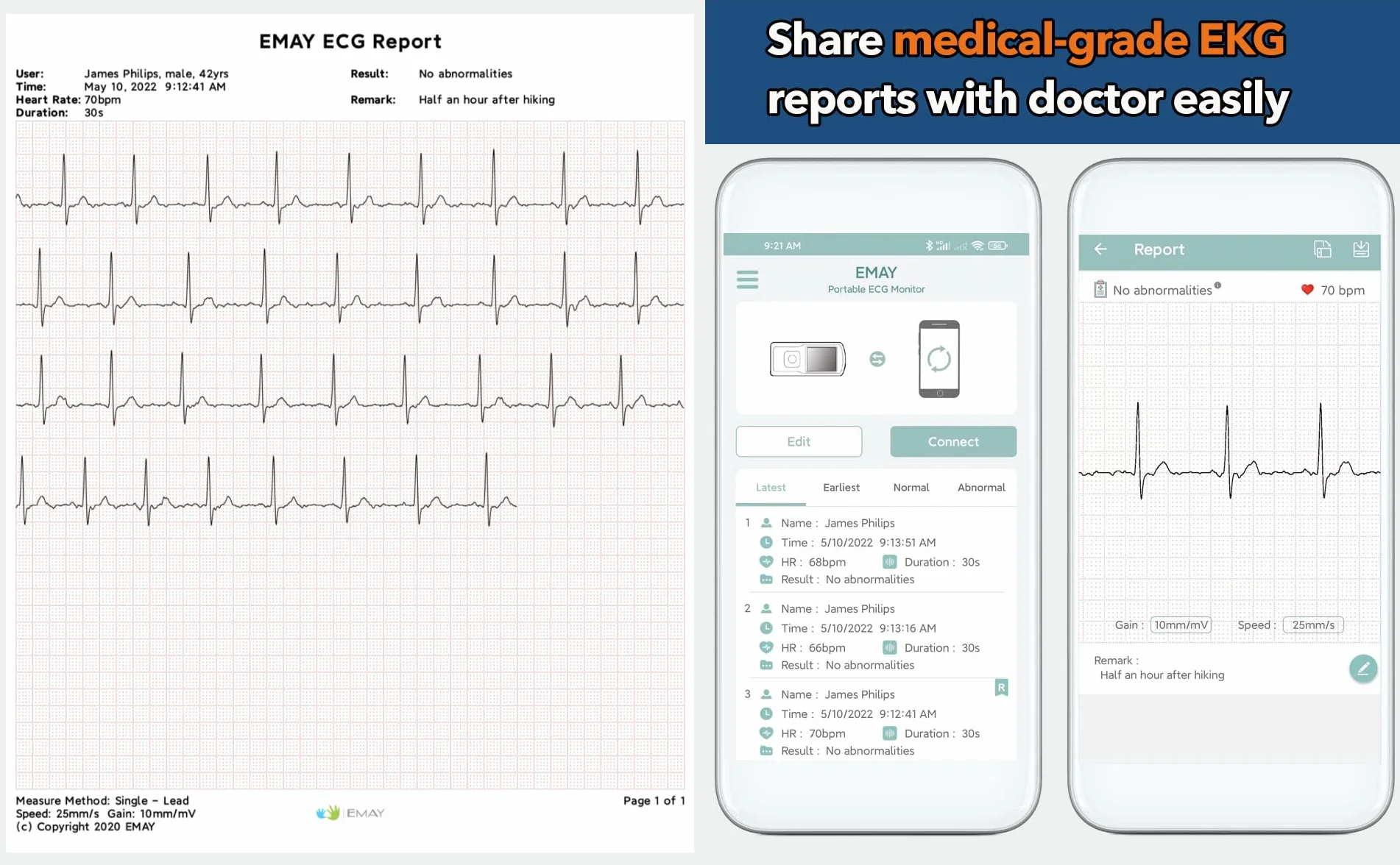 EMAY Bluetooth Moniteur ECG Portable EMG-20 sans Fil Mobile Electrocardiographe