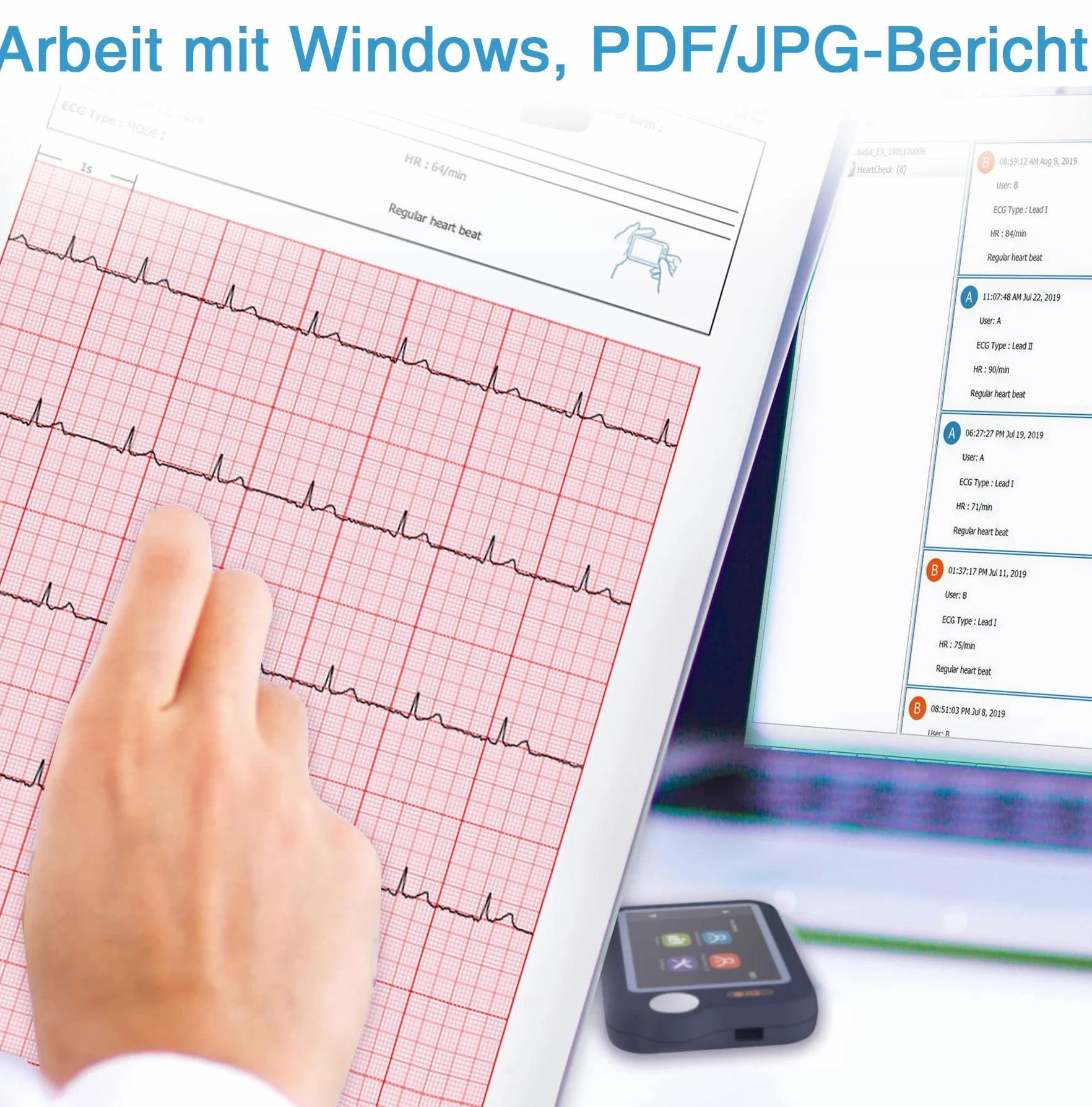ViATOM Appareil ECG Portable – Moniteur ECG Bluetooth avec Affichage en Temps Réel et Mémoire Illimitée