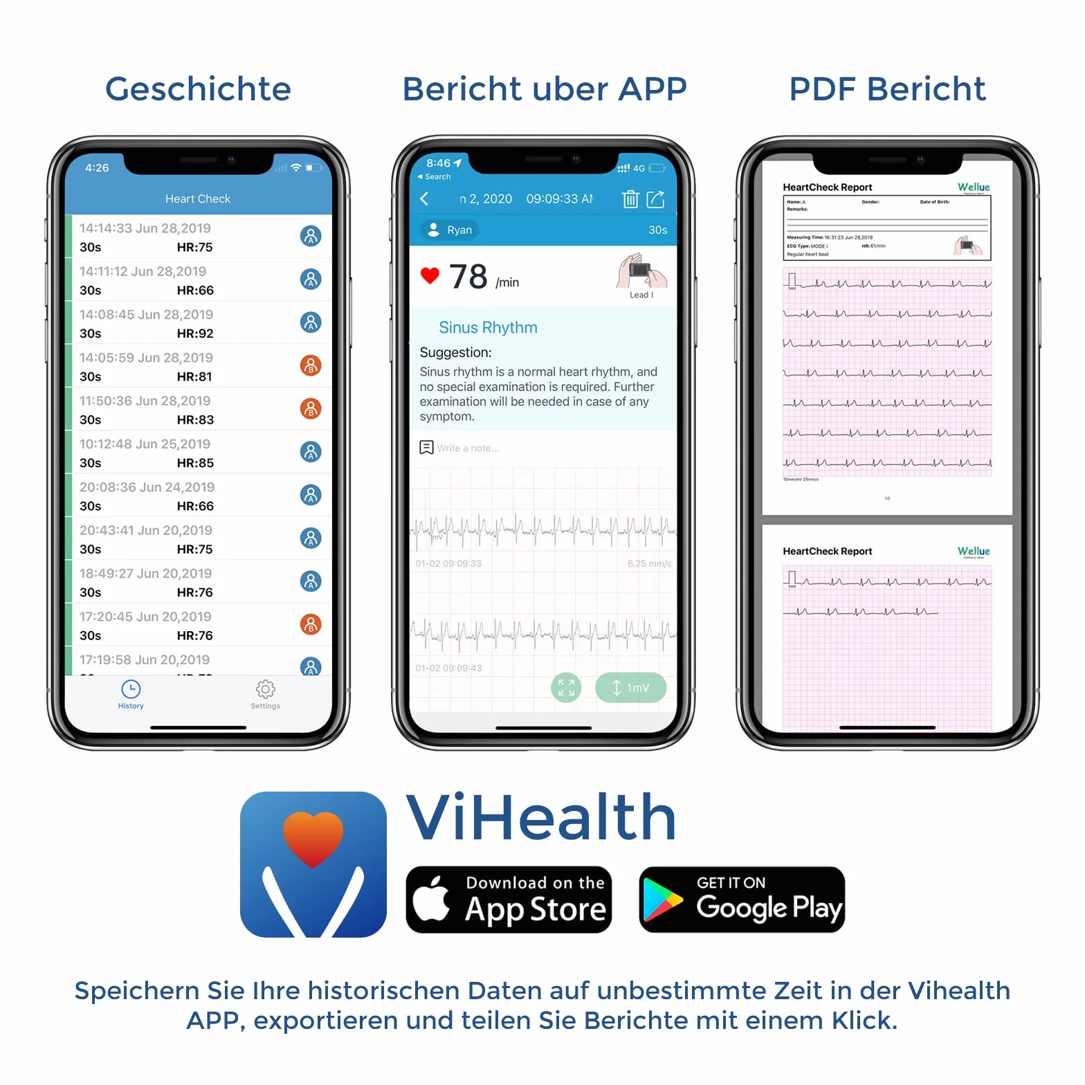 ViATOM Appareil ECG Portable – Moniteur ECG Bluetooth avec Affichage en Temps Réel et Mémoire Illimitée
